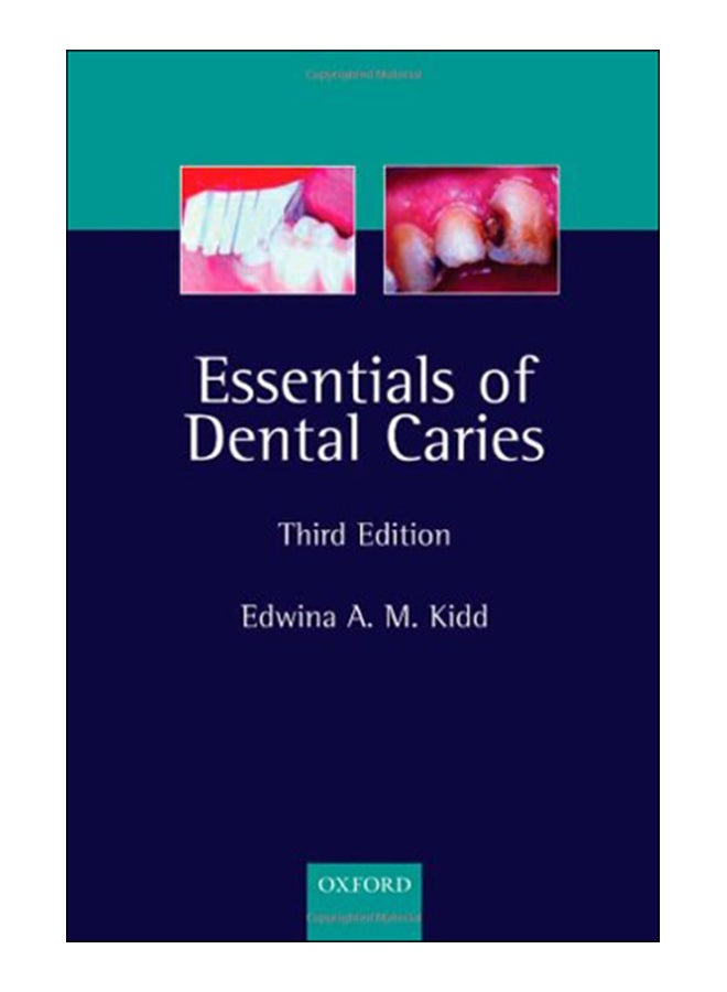 Essentials Of Dental Caries Paperback English by Edwina Kidd - 5-May-05 