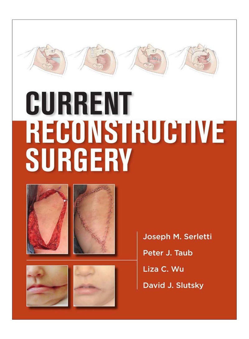 Current Reconstructive Surgery hardcover english - 16-Dec-12 