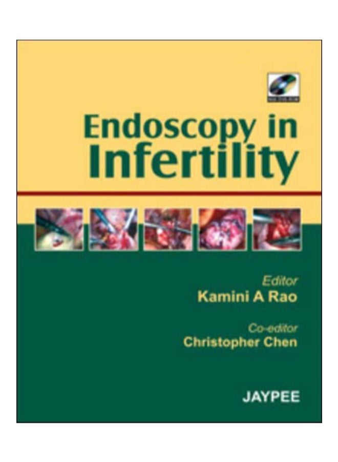 Endoscopic Infertility hardcover english - 30-May-08 