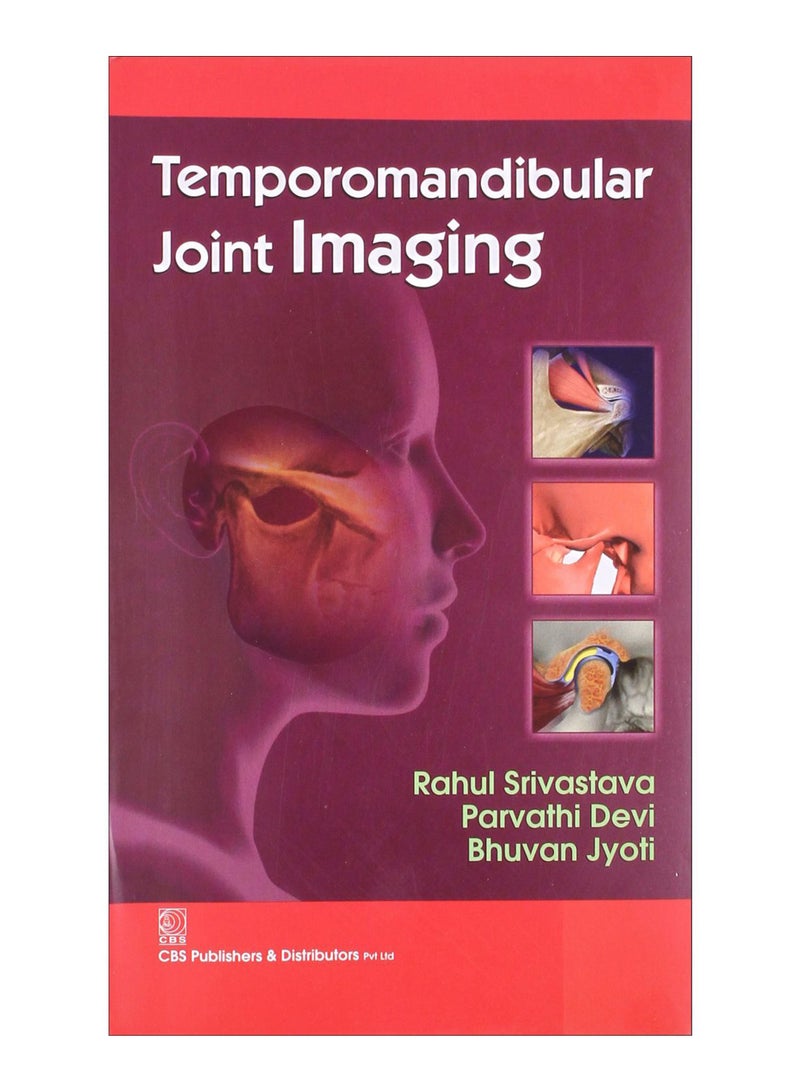 Temporomandibular Joint Imaging Paperback English by R. Srivastava - 31-Jan-14