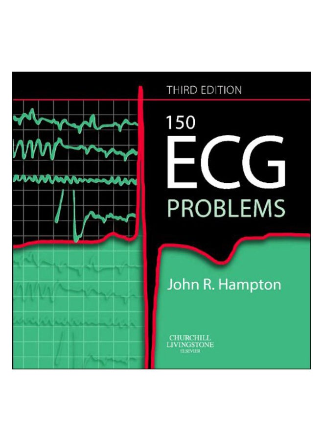 150 ECG Problems paperback english - 11 Jun 2008
