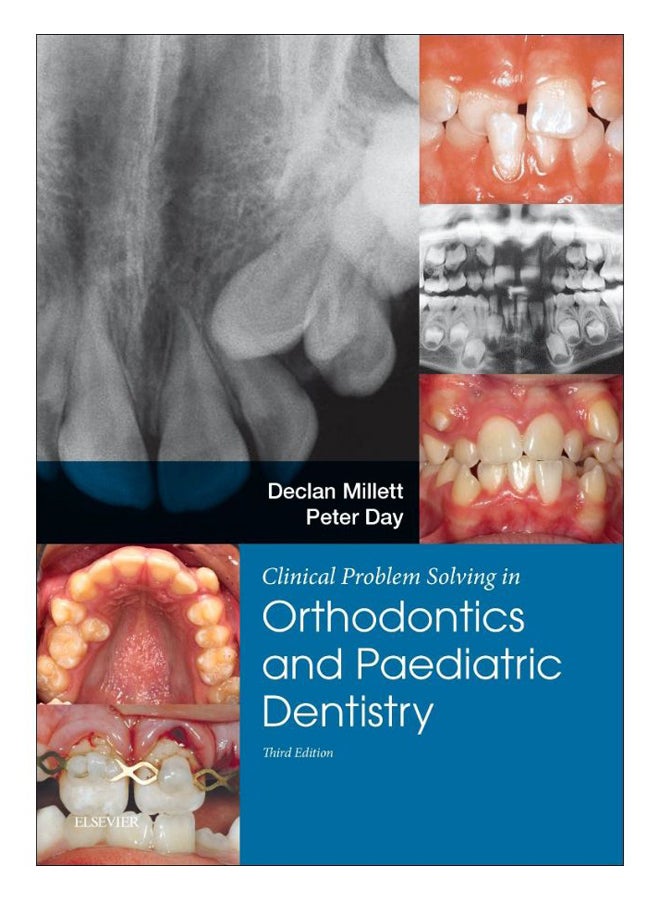 Orthodontics And Paediatric Dentistry Paperback English by Declan Millett - 7-Dec-16 