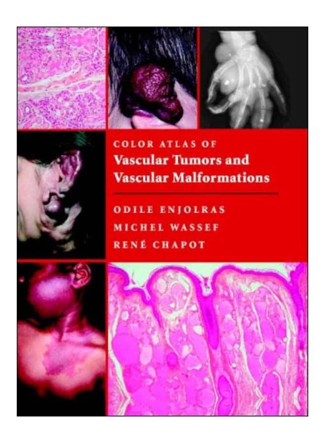 Color Atlas Of Vascular Tumors And Vascular Malformations hardcover english - 2-Apr-07 