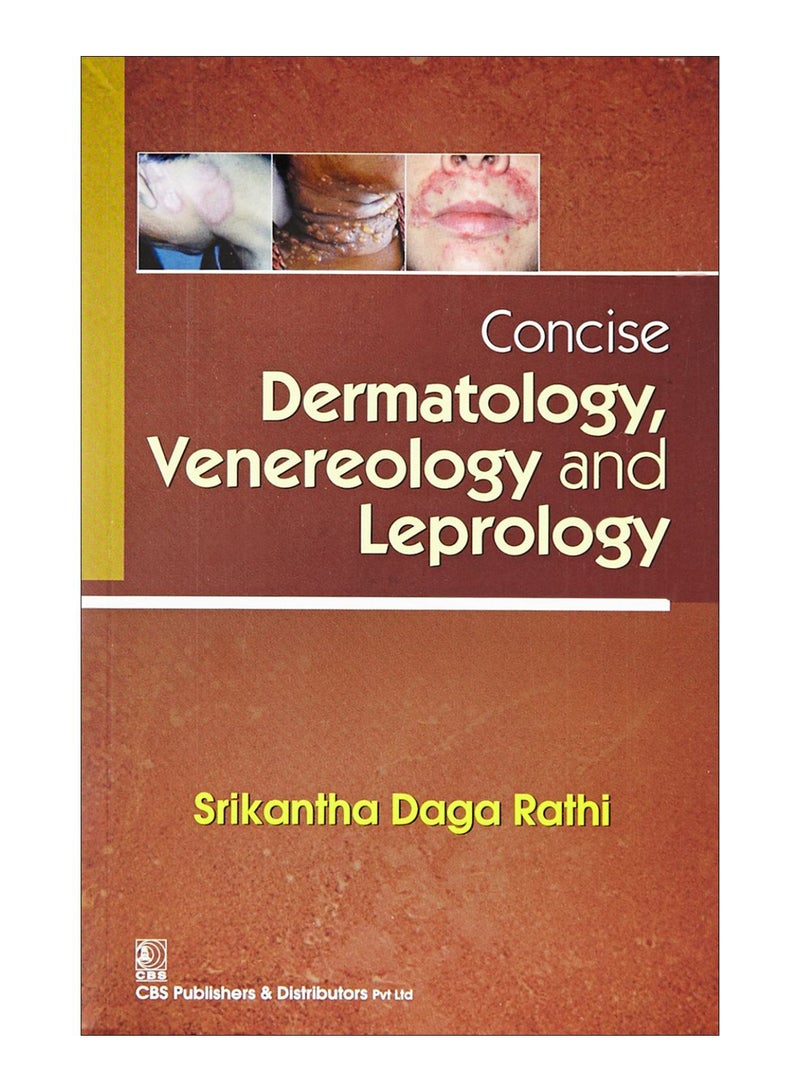 Concise Dermatology, Venereology And Leprology Paperback English by Rathi - 1-Jan-17 