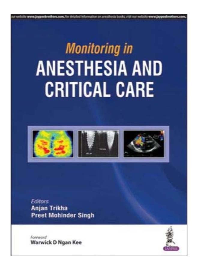 Monitoring In Anesthesia And Critical Care paperback english - 31-May-18 