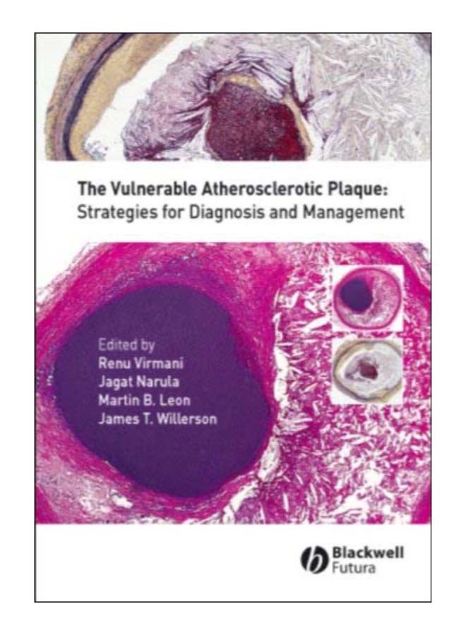 The Vulnerable Atherosclerotic Plaque hardcover english - 30-Oct-06