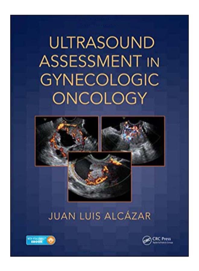 Ultrasound Assessment In Gynecologic Oncology Hardcover English by Juan Luis Alcazar - 29-Mar-18