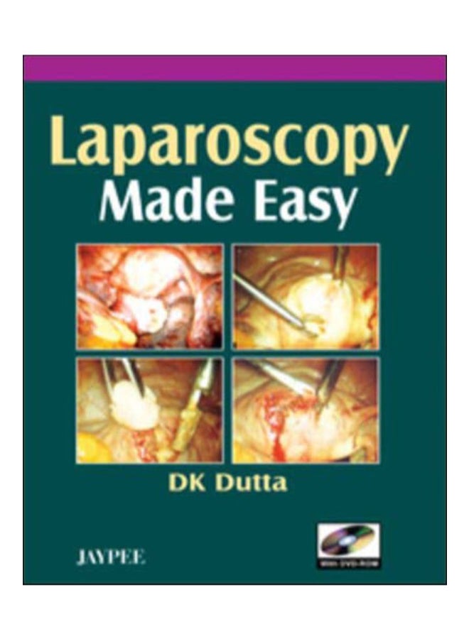 Laparoscopy Made Easy Paperback English by D. K. Dutta 