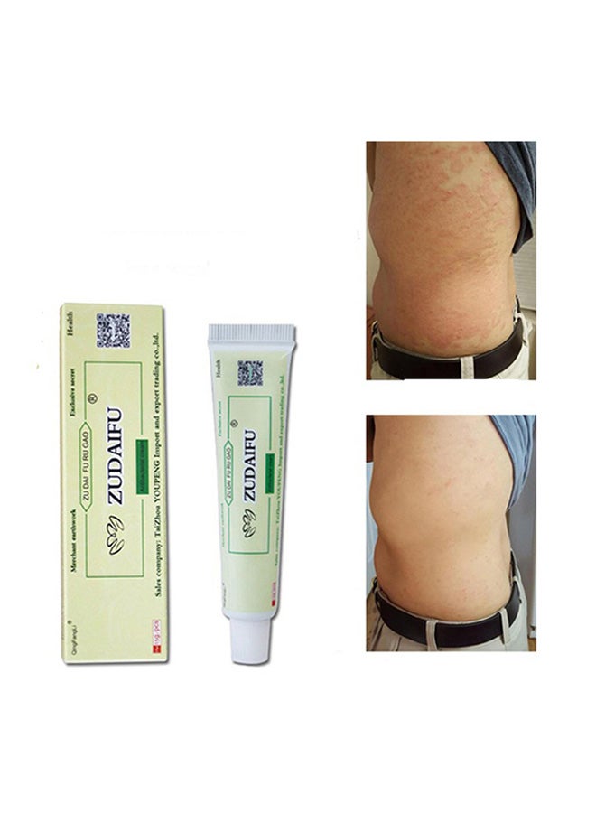 zudaifu - Antibacterial Ointment Eczema Peeling Herbal Cream - Image 1
