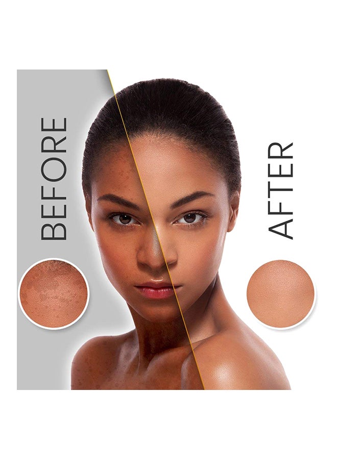 Makari Acne Fighting Sulfur Soap Bar - Image 3