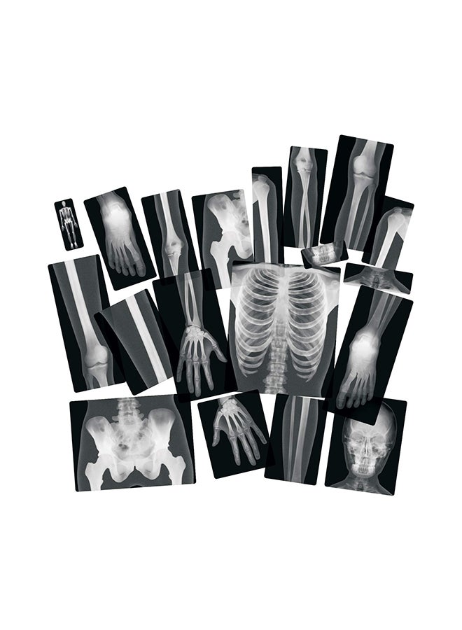 Roylco True To Life Human X-Rays 18.1x11.4x0.1inch  - Image 3