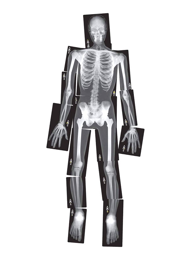 Roylco True To Life Human X-Rays 18.1x11.4x0.1inch  - Image 1
