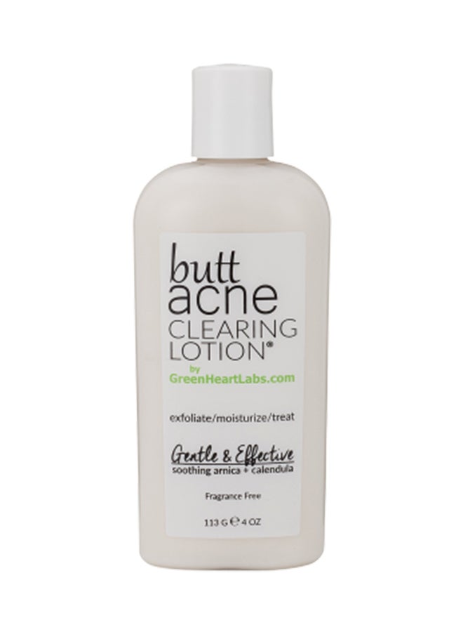 Butt Acne Clearing Lotion