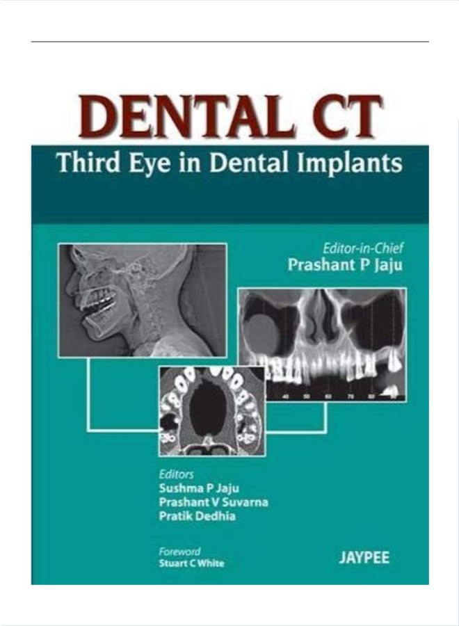 Dental Ct Third Eye In Dental Implants hardcover english - 41305