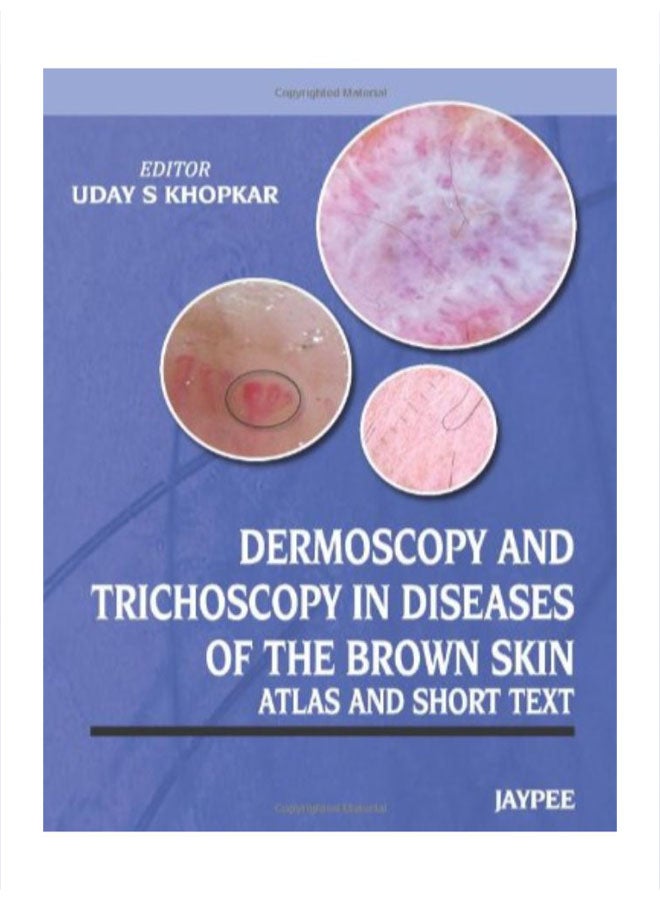 Dermoscopy And Trichoscopy In Diseases Of The Brown Skin Atlas And Short Text paperback english - 41670 