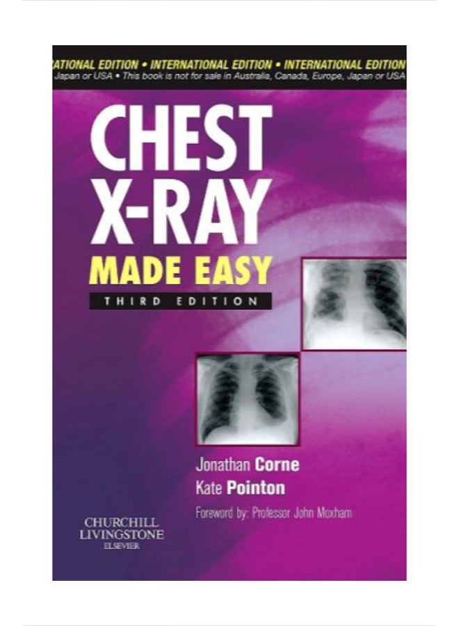 Chest X-Ray Made Easy paperback english - 40969 