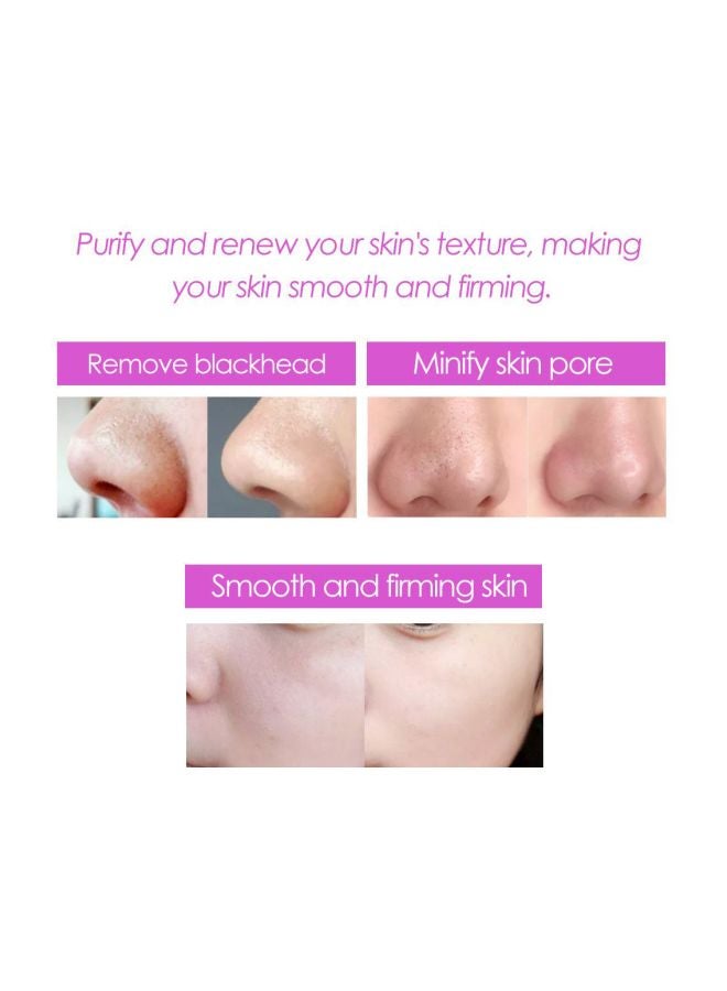 Ultrasonic Facial Skin Deep Cleansing Massager White - Image 4