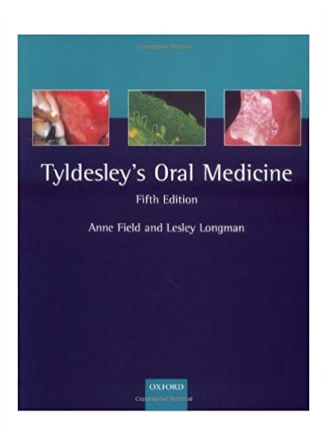 Tyldesley's Oral Medicine Paperback English by William Tyldesley