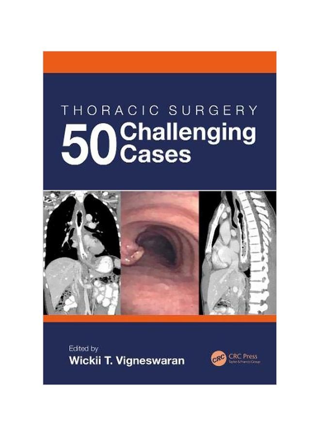 Thoracic Surgery: 50 Challenging Cases paperback english - 11-Dec-19 