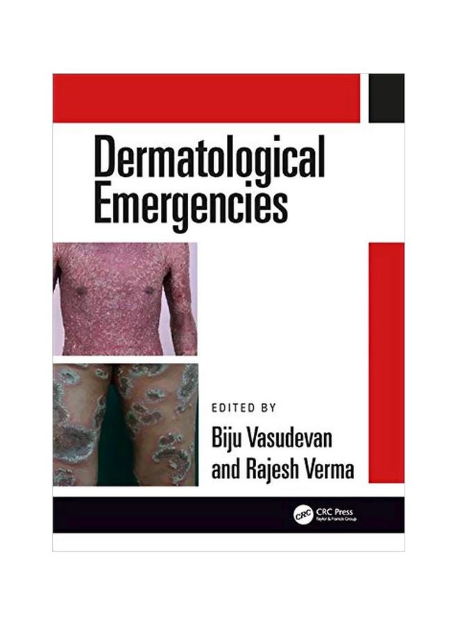 Dermatological Emergencies Hardcover English - 03-Jul-19 