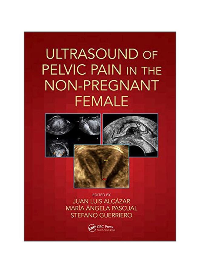 Ultrasound Of Pelvic Pain In The Non-pregnant Female paperback english 