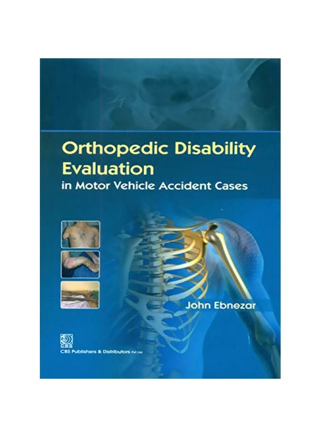 Orthopedic Disability Evaluation: In Motor Vehicle Accident Cases hardcover english - 30 Aug 2014 