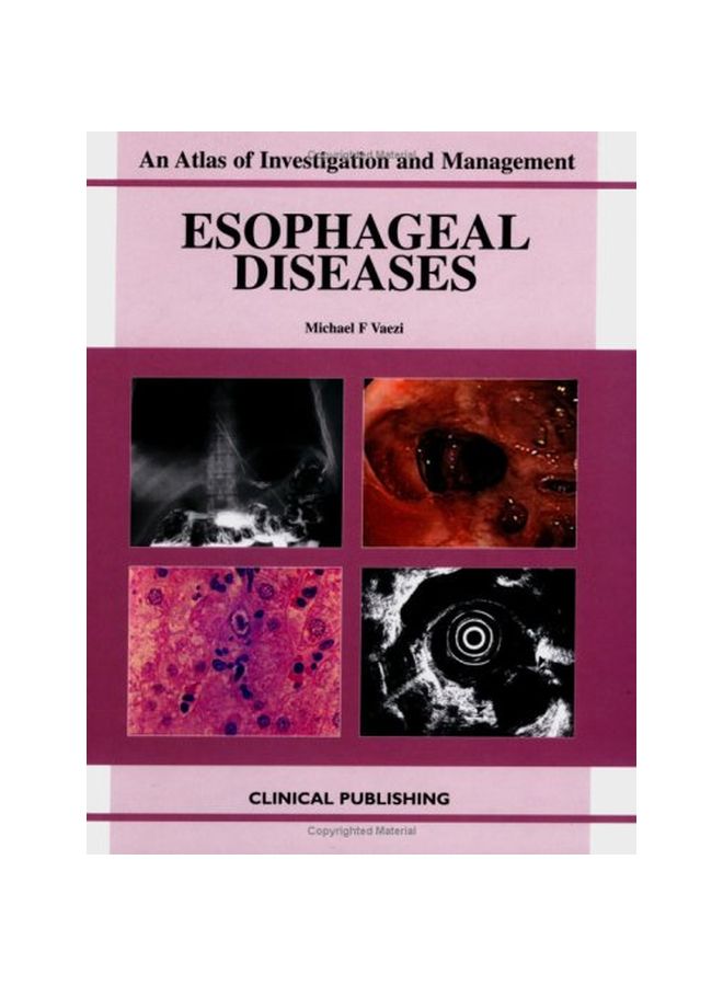 Esophageal Diseases hardcover english - 04 Jul 2012 