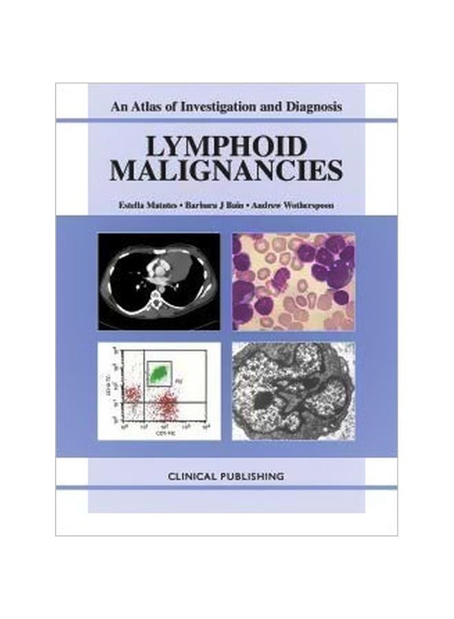 Lymphoid Malignancies hardcover english - 16 Oct 2007