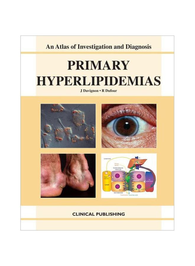 Primary Hyperlipidemias hardcover english - 01 Aug 2007 