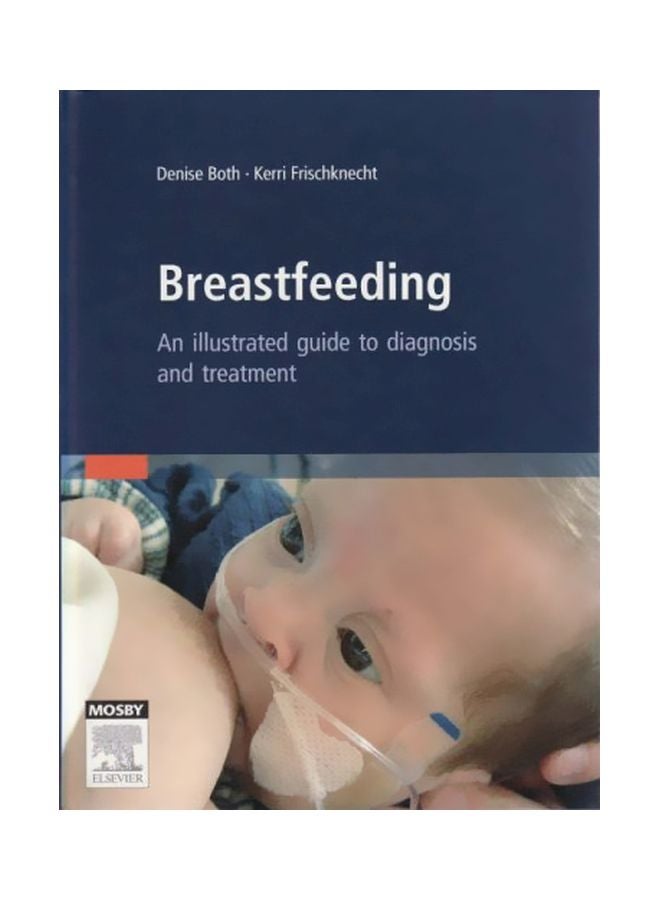 Breastfeeding: An Illustrated Guide To Diagnosis And Treatment hardcover english - 14 Jul 2008 
