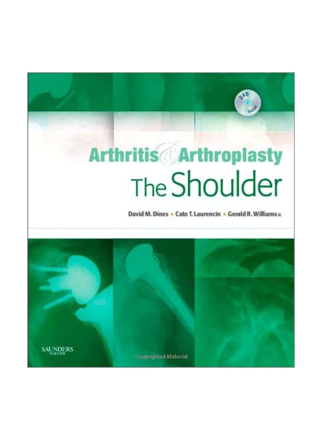 Arthritis And Arthroplasty: The Shoulder hardcover english - 22 Jul 2009 
