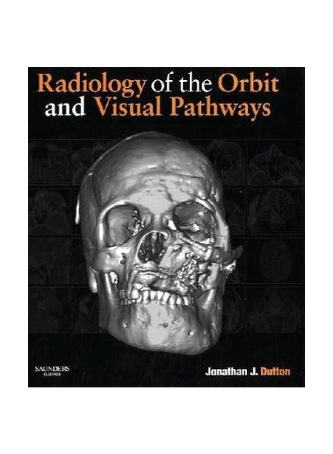Radiology Of The Orbit And Visual Pathways Hardcover English by Jonathan J Dutton - 10 Jun 2010 