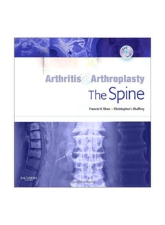 Arthritis And Arthroplasty: The Spine hardcover english - 08 Sep 2011 