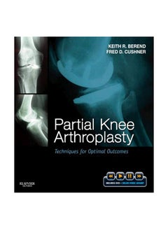 Partial Knee Arthroplasty: Techniques For Optimal Outcomes hardcover english - 13 Oct 2011 