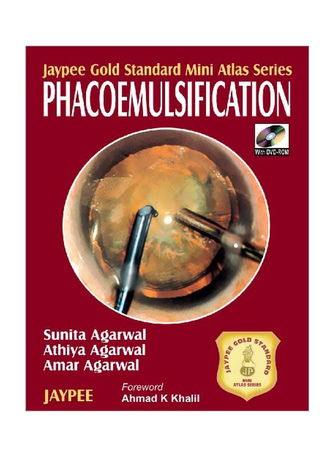 Phacoemulsification With Dvd Rom paperback english - 30 May 2008