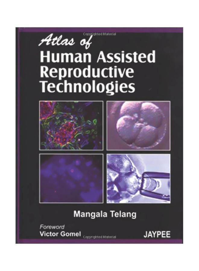 Atlas Of Human Assisted Reproductive Technoloies Paperback English by Margala Telang - 30 May 2007