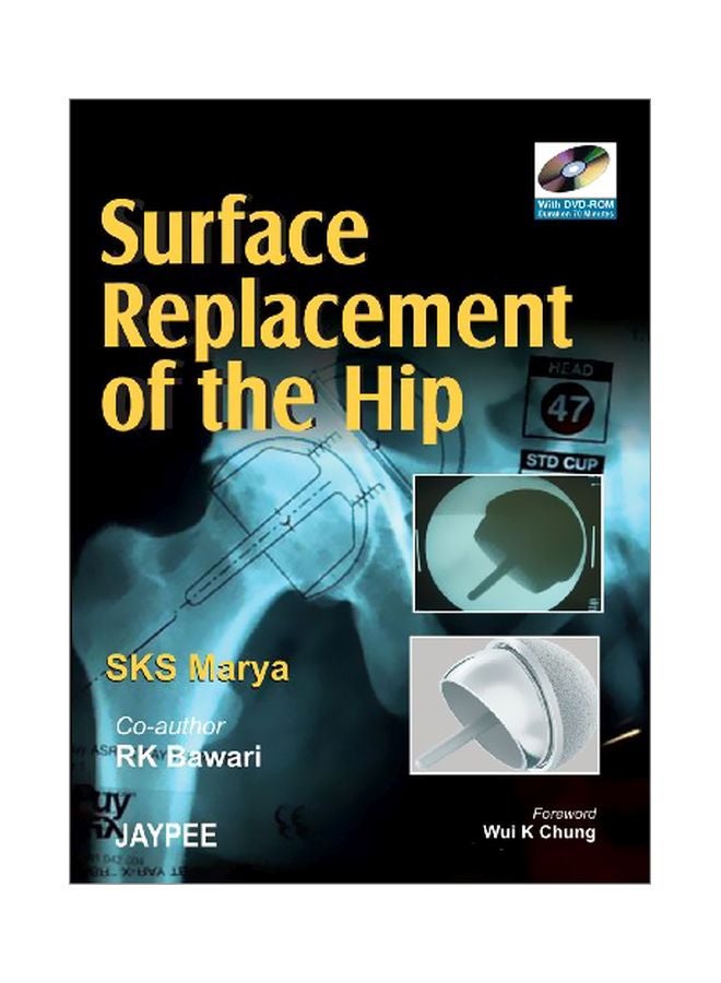 Surface Replacement Of The Hip Audiobook English by S. K. S. Marya - 20 Jun 2007 
