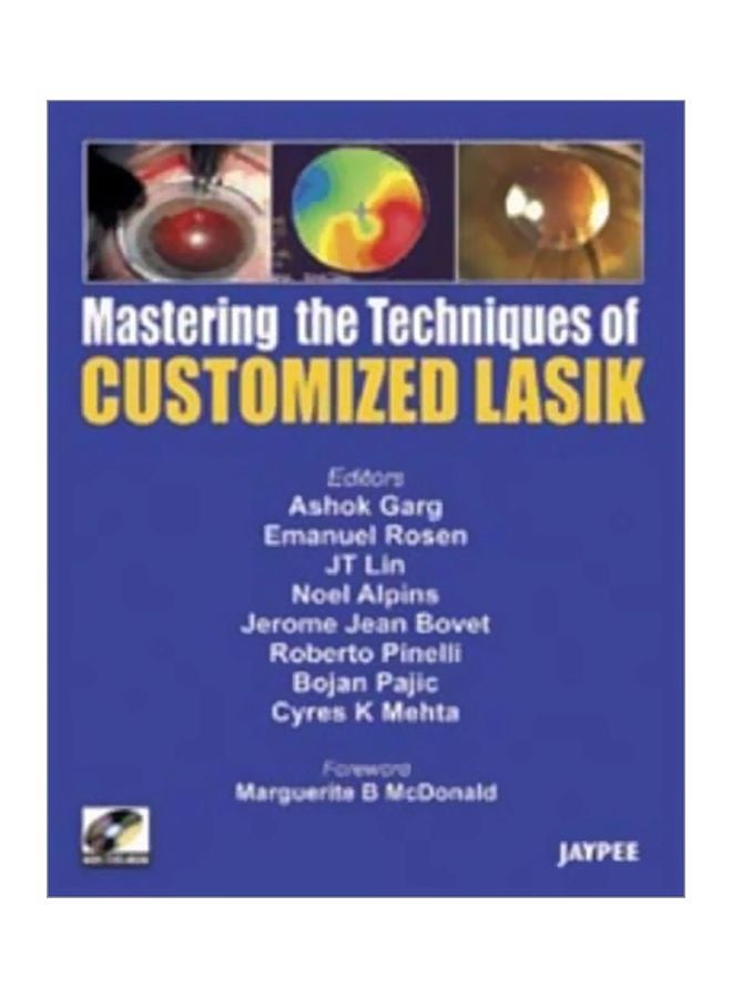 Mastering The Technique Of Customized Lasik English by Ashok Garg - 30 Jun 2007 