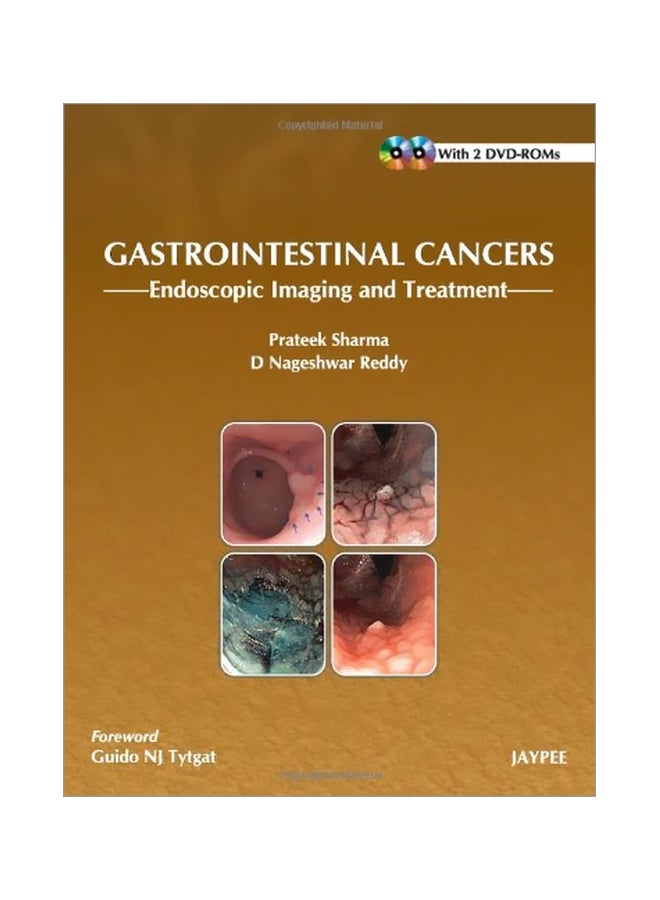 Gastrointestinal Cancers: Endoscopic Imaging And Treatment ebook english - 31 Jan 2013 