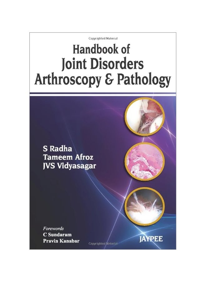 Handbook Of Joint Disorders Arthroscopy And Pathology paperback english - 30 Jun 2013 