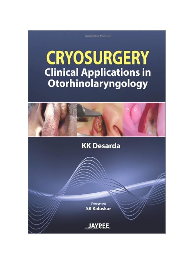 Cryosurgery : Clinical Applications In Otorhinolaryngology paperback english - 01 Jan 2013 