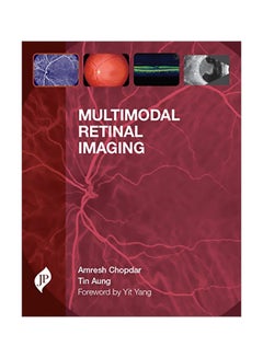 Multimodal Retinal Imaging hardcover english - 22 Aug 2014 - v1583409185/N35349325A_1