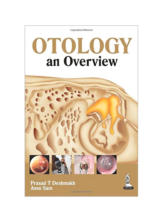 Otology: An Overview paperback english - 01 Apr 2014 