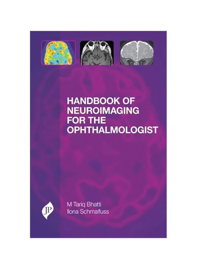 Handbook Of Neuroimaging For The Ophthalmologist hardcover english - 28 Apr 2014 