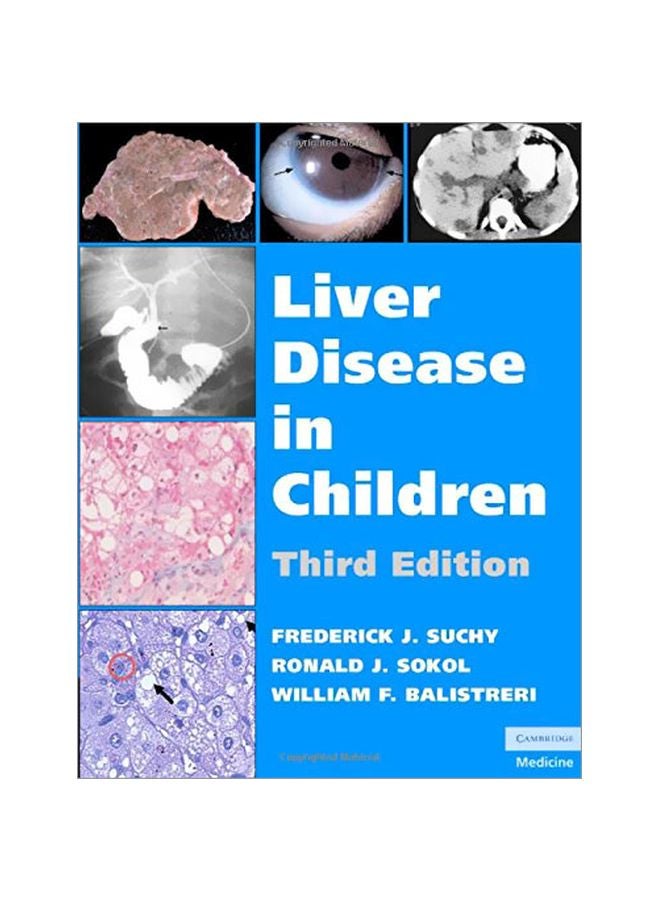 Liver Disease In Children hardcover english - 39233.0