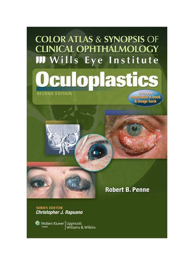 Color Atlas And Synopsis Of Clinical Ophthalmology paperback english - 18 May 2012 