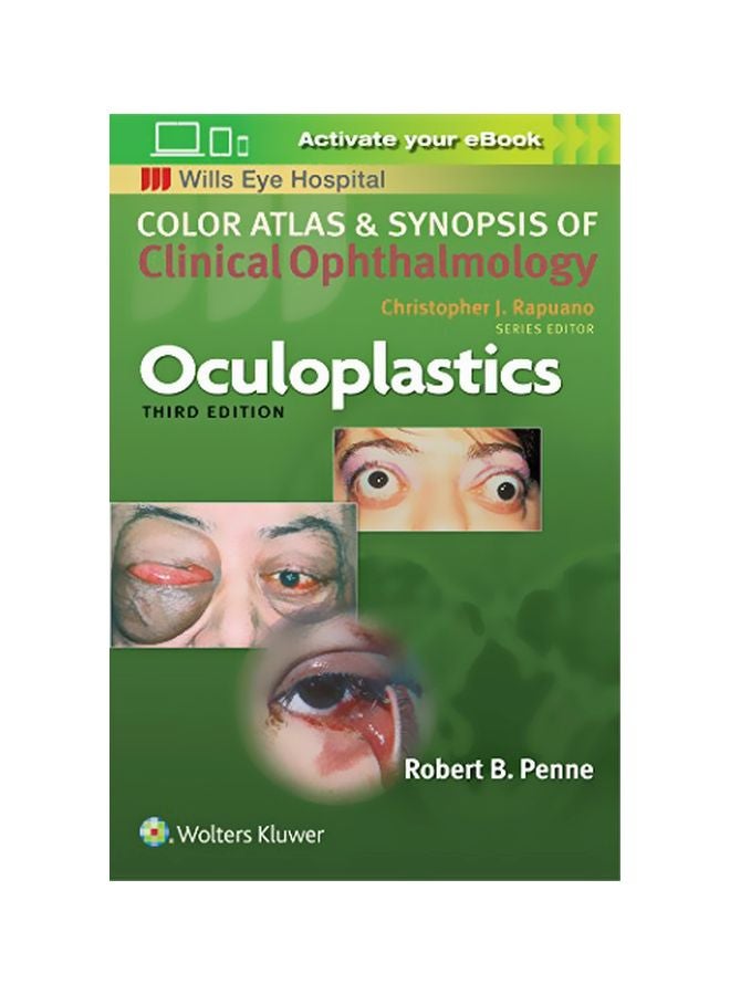 Oculoplastics: Clinical Ophthalmology paperback english - 02 Jun 2018 