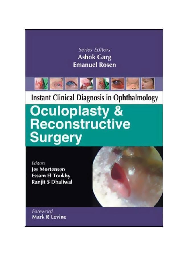 Instant Clinical Diagnosis In Ophthalmology: Oculoplasty And Reconstructive Surgery paperback english - 1 Aug 2009 