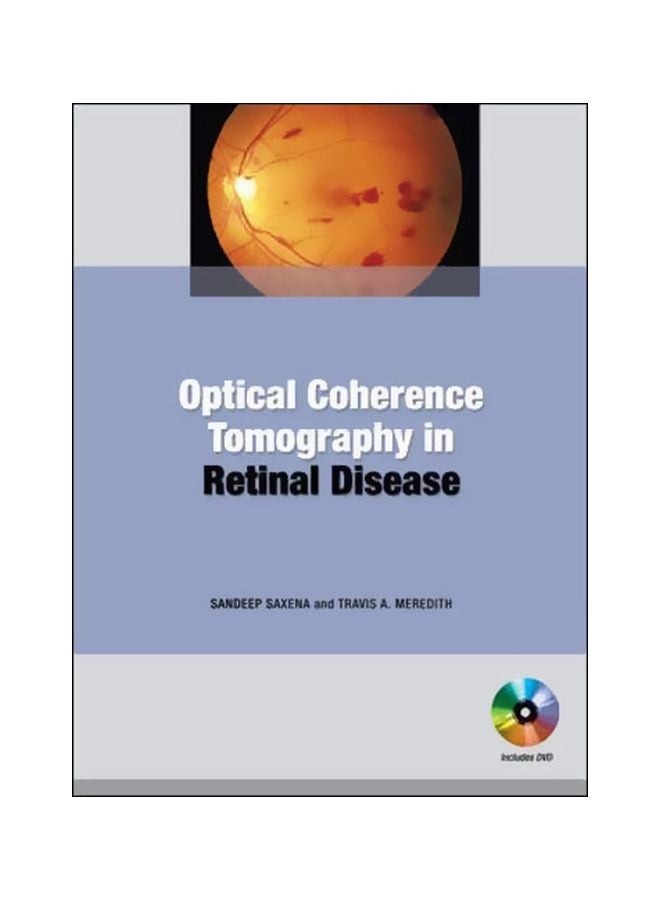 Optical Coherence Tomography In Retinal Disease Paperback English by Sandeep Saxena - 04 Dec 2008 