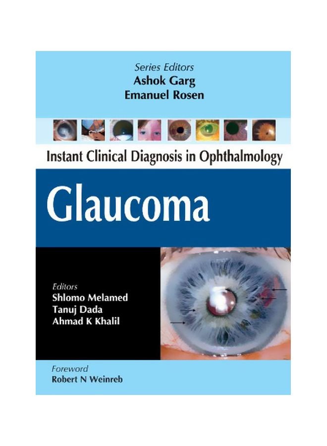 Glaucoma: Iinstant Clinical Diagnosis In Ophthalmology Paperback English by Hoffman - 08 Jul 2011 